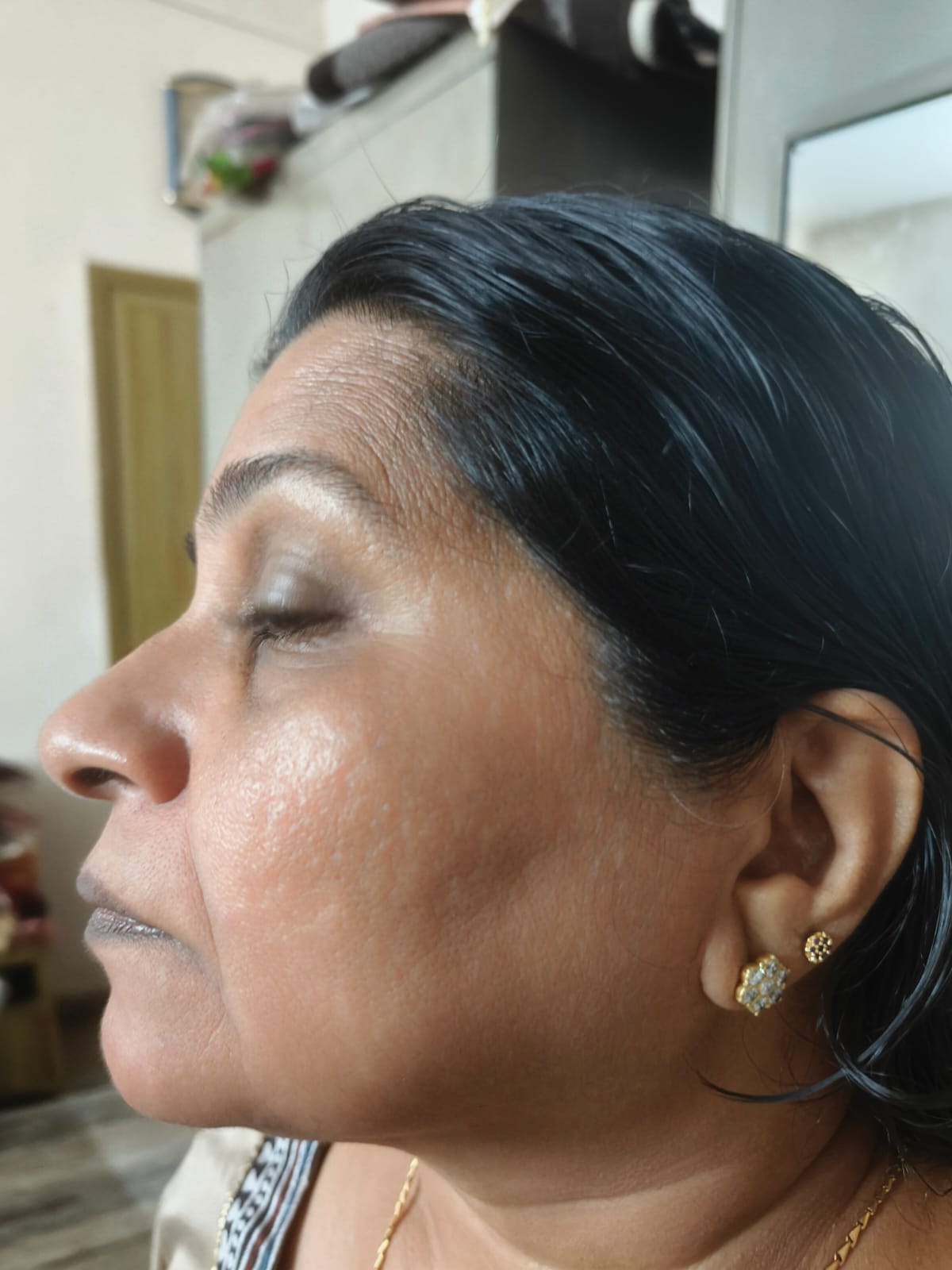 After using Kumkumadi Face Cream